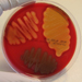 A blood agar plate growing Group B strep (beta hemolysis), Group A strep (pronounced beta hemolysis), and Strep pneumoniae (alpha hemolysis).