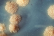 This is a close-up of a Mycobacterium tuberculosis culture revealing this organism’s colonial morphology.    Note the colorless, rough surface, which are typical morphologic characteristics seen in Mycobacterium tuberculosis colonies. Macroscopic examination of colonial growth patterns is still one of the ways microorganisms are often identified.