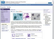 Giardiasis
