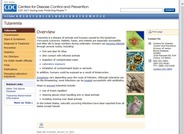 Tularemia