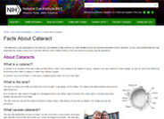Facts About Cataract
